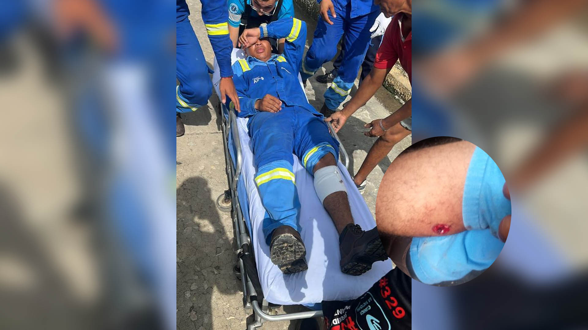 El contratista herido por un ataque a bala