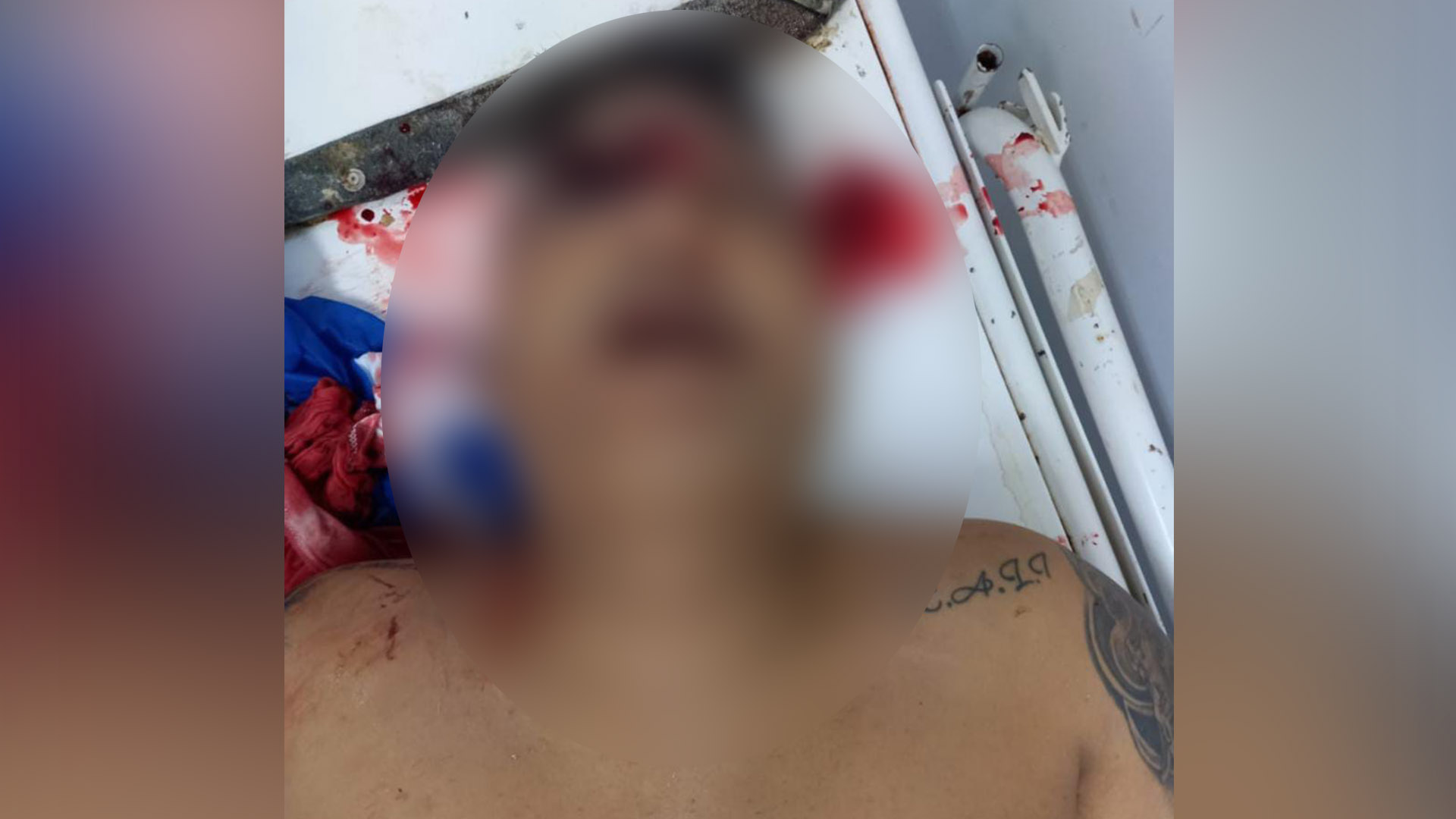 Aspecto del cuerpo sin vida