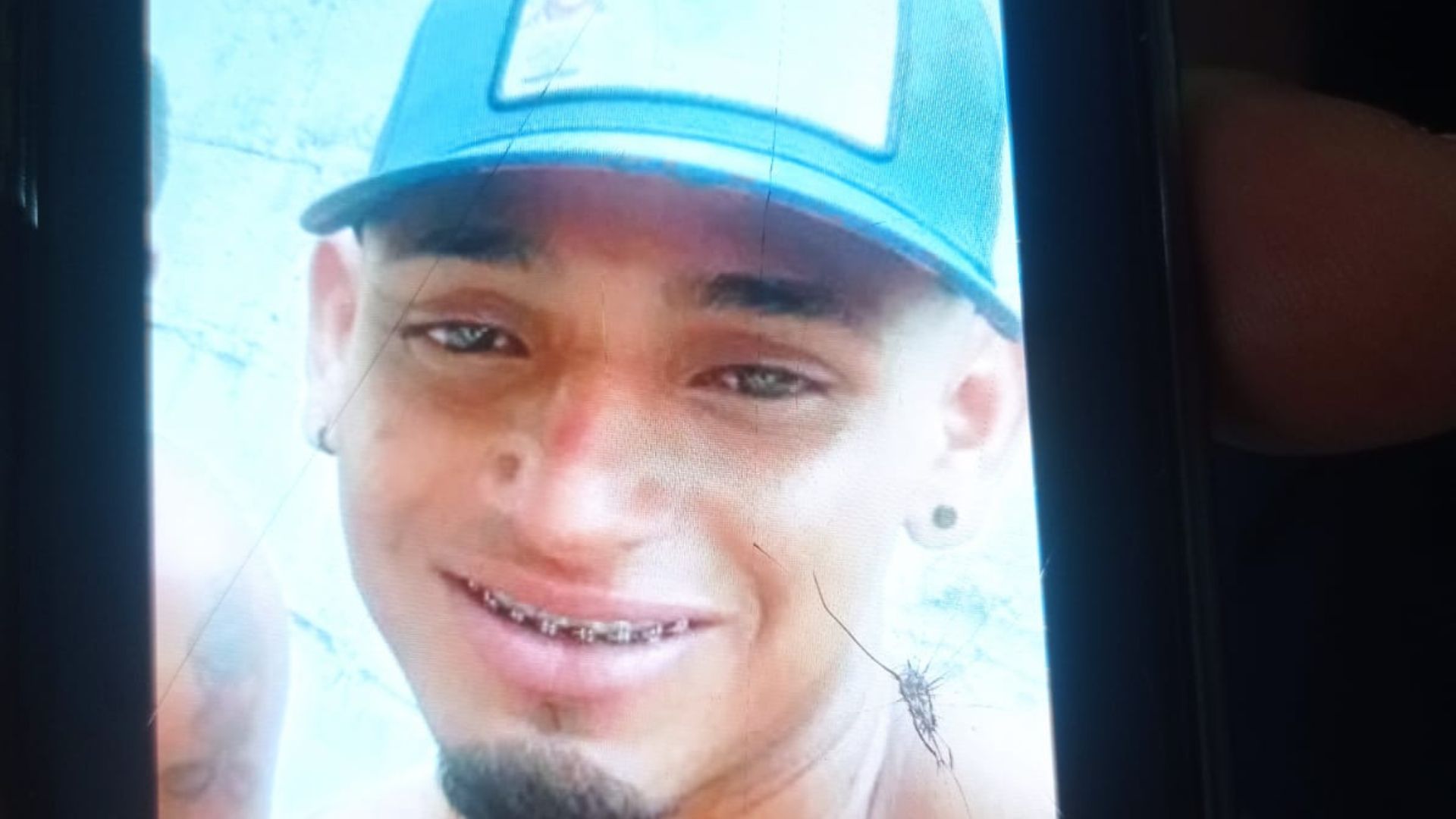 Alias Yarol, herido en atentado a bala en Sabanalarga.