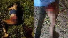 El impacto con el camión le arrancó una de las piernas a la mujer. 