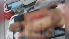 Aspecto del fallecido en la noche de este domingo.