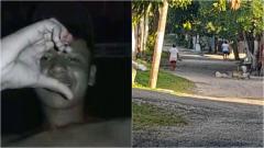 Jonathan Escobar, de 21 años de edad, resultó herido a bala y se recupera en la Clínica Reina Catalina.