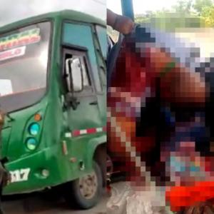 El deceso de la víctima se confirmó en la Clínica San Ignacio.