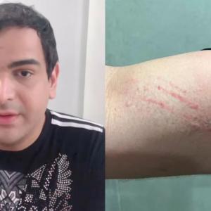 Alejandro Palacio reportó agresiones en su cuenta de Instagram.