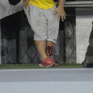 Aspecto de la herida de uno de los enfrentados durante el cotejo en el estadio Metropolitano. 