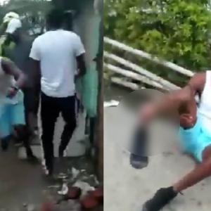 El hombre herido tras el presunto abuso policial. 