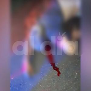 El hecho tuvo lugar en horas de la noche de este sábado 21 de enero