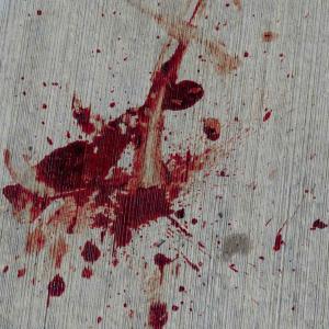 Aspecto de una escena del crimen