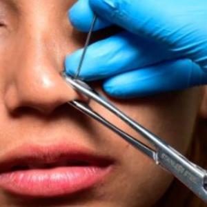 Imagen de referencia.