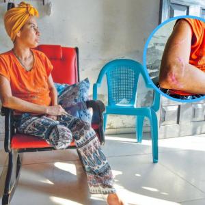 Milena Altamar, herida con arma blanca.