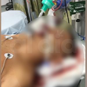 Aspecto del hombre herido