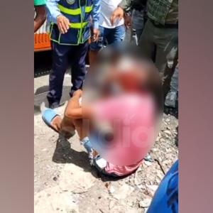 El ladrón terminó ensangrentado por cuenta del fuerte impacto sufrido