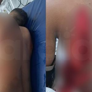 Las heridas sufridas por la víctima, en imágenes censuradas para proteger de sensibilidades