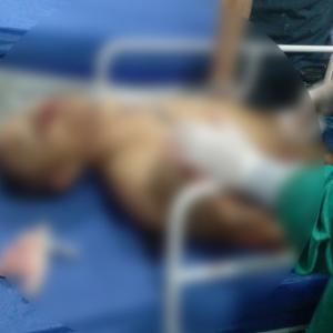 El sujeto tras llegar a un centro médico en el que se confirmó su muerte. 