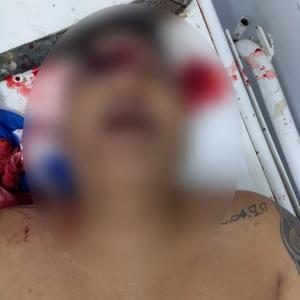 Aspecto del cuerpo sin vida