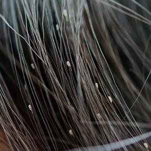 Imagen de referencia