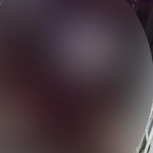 Imagen censurada para evitar sensibilidades