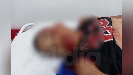 El sujeto murió en horas de la noche de este viernes. Los siete impactos de bala fueron propinados por sujetos en moto. 