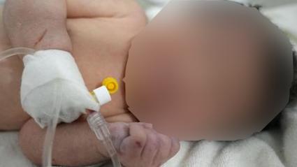 La historia de la bebé recién nacida le ha dado la vuelta al mundo.