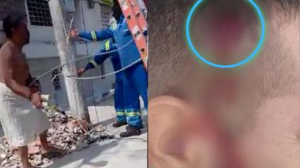 Momento en el que el ciudadano hiere a operario de Air-e / Herida de operario de Air-e