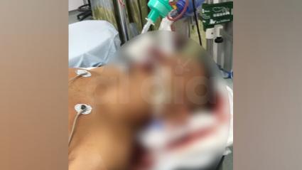 Aspecto del hombre herido