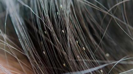 Imagen de referencia