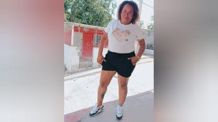 Víctima de ataque a bala en La Sierrita.